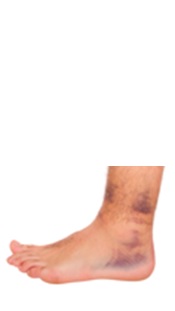 foot foot