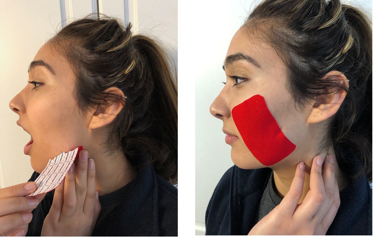 Sleep Bruxism? K Tape may help Advanced Physical Therapy Education Institute