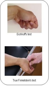 eickhoff test vs finkelstein)