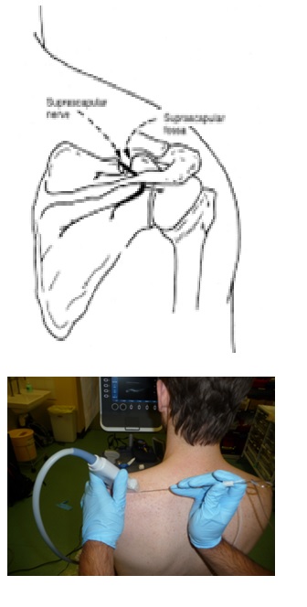 z1 z1